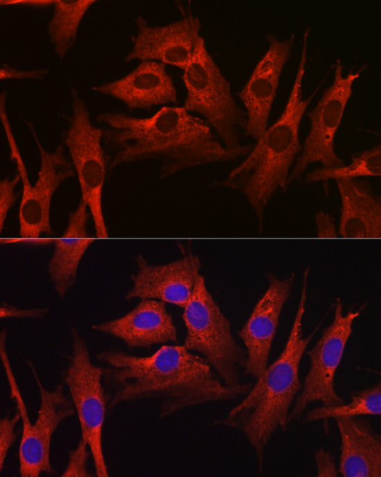 HMGCR Rabbit Polyclonal Antibody - Image 7