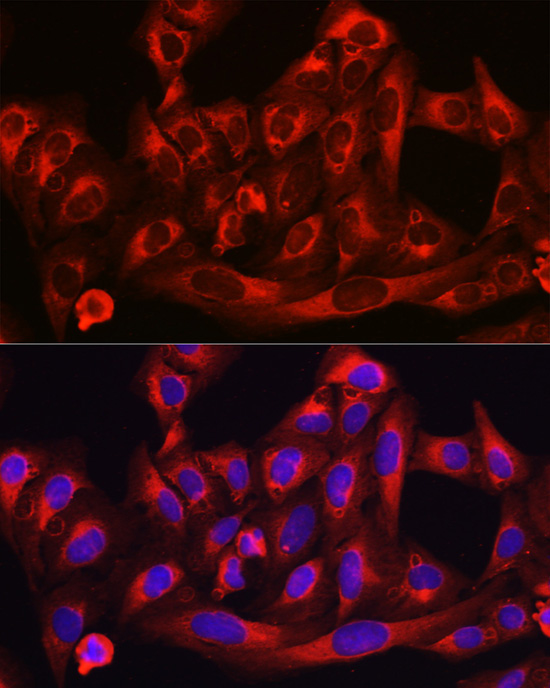 HMGCR Rabbit Polyclonal Antibody - Image 8