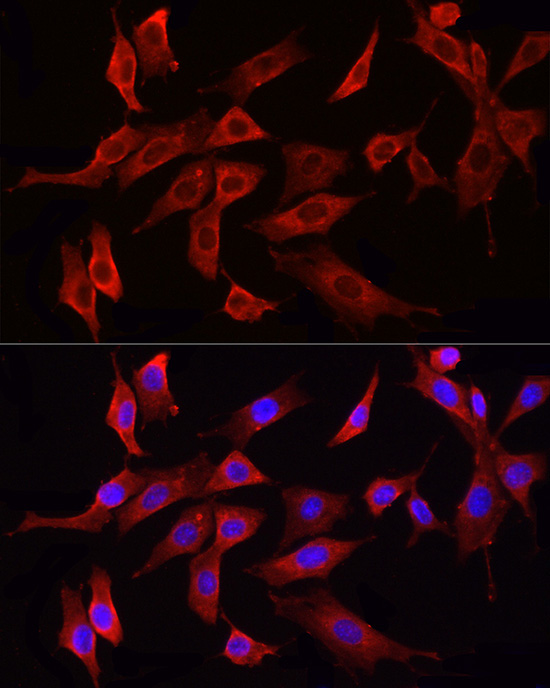 HMGCR Rabbit Polyclonal Antibody - Image 9