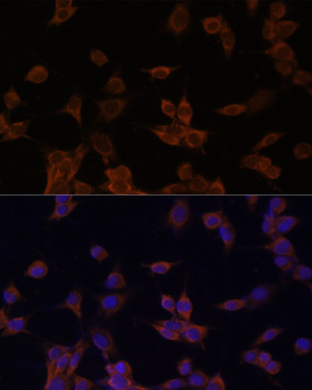 HMGCR Rabbit Polyclonal Antibody - Image 2