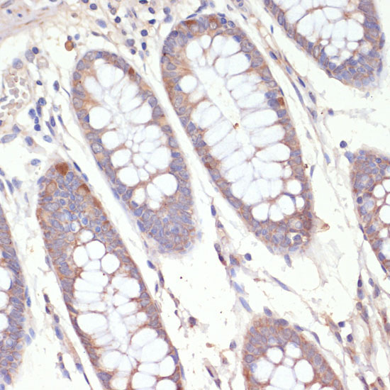 HMGCR Rabbit Polyclonal Antibody - Image 2