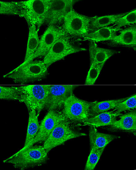 HMGCR Rabbit Polyclonal Antibody - Image 3