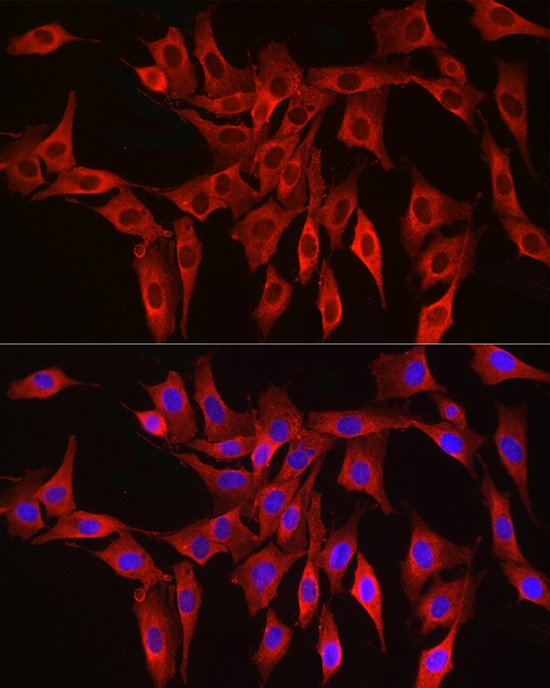 HMGCR Rabbit Polyclonal Antibody - Image 4