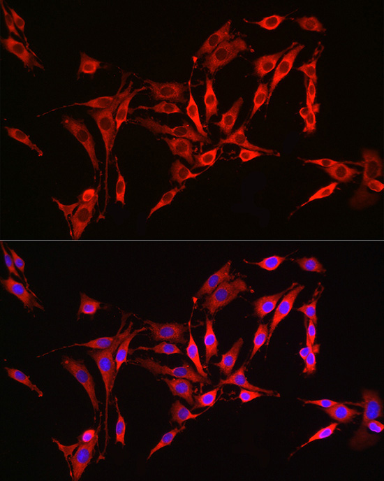 HMGCR Rabbit Polyclonal Antibody - Image 5