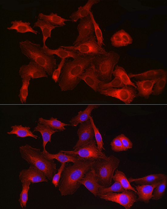 HMGCR Rabbit Polyclonal Antibody - Image 6
