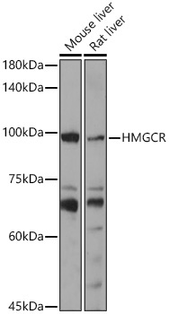 HMGCR Rabbit Polyclonal Antibody
