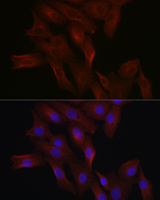 HMGCR Rabbit Polyclonal Antibody - Image 2