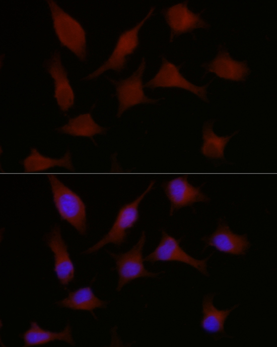 HMGCR Rabbit Polyclonal Antibody - Image 3