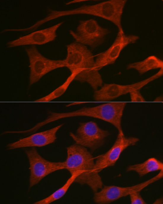 HMGCR Rabbit Polyclonal Antibody - Image 4