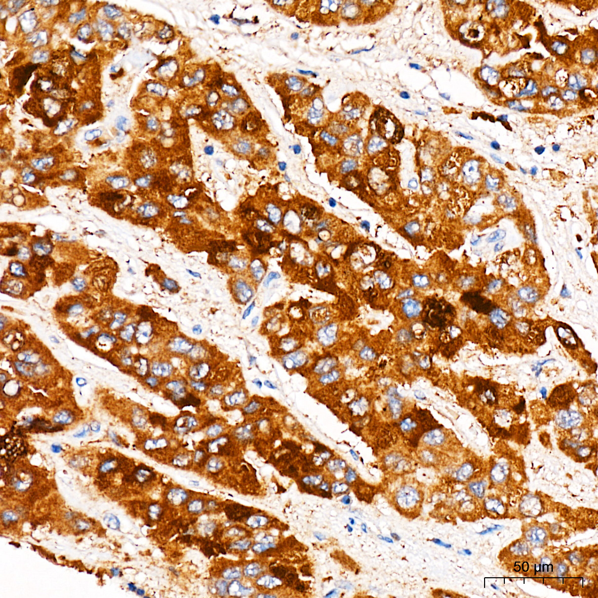 HMGCR Rabbit Polyclonal Antibody