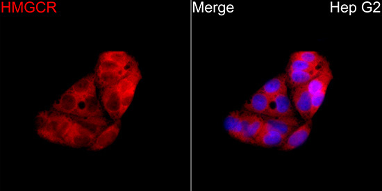 HMGCR Rabbit Polyclonal Antibody - Image 2