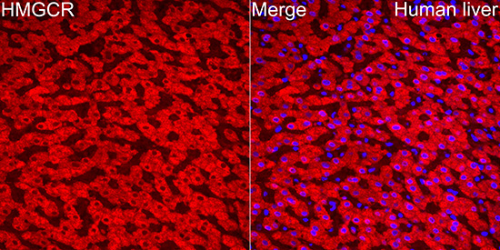 HMGCR Rabbit Polyclonal Antibody - Image 3