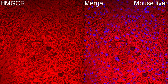 HMGCR Rabbit Polyclonal Antibody - Image 4