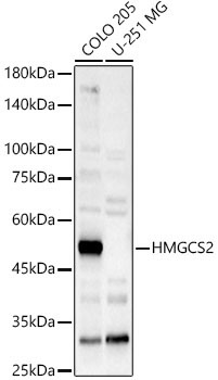 HMGCS2 Rabbit Polyclonal Antibody