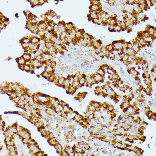 HMGCS2 Rabbit Polyclonal Antibody - Image 2