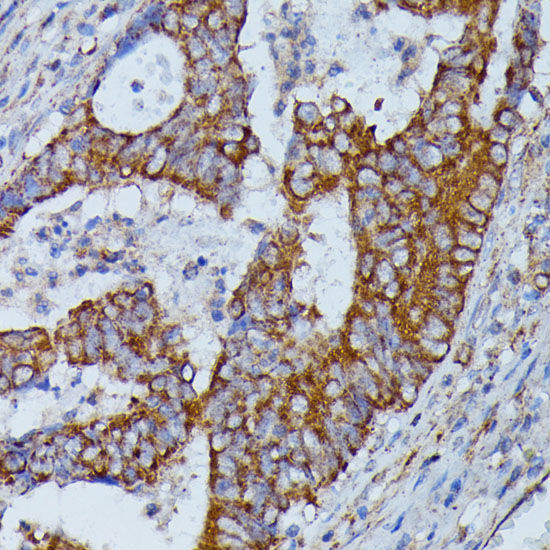 HMGCS2 Rabbit Polyclonal Antibody - Image 3