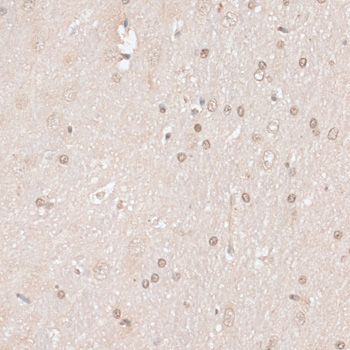 HMGN1 Rabbit Polyclonal Antibody