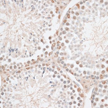 HMGN1 Rabbit Polyclonal Antibody - Image 2