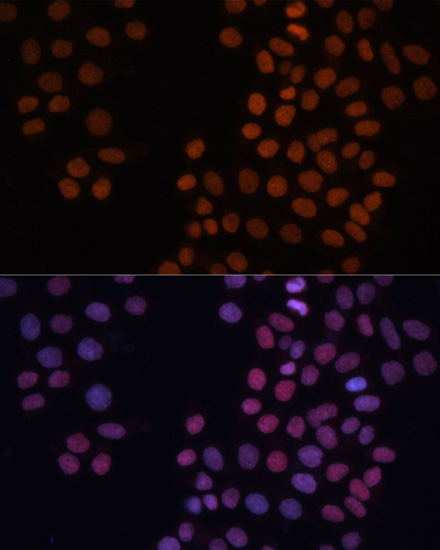 HMGN1 Rabbit Polyclonal Antibody - Image 2