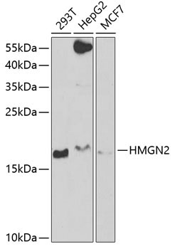 HMGN2 Rabbit Polyclonal Antibody
