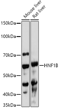 HNF1B Rabbit Polyclonal Antibody