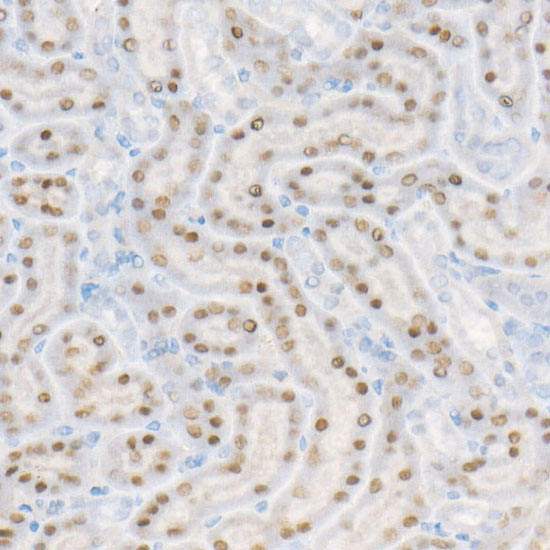 HNF1Alpha Rabbit Monoclonal Antibody