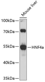 HNF4a Rabbit Polyclonal Antibody