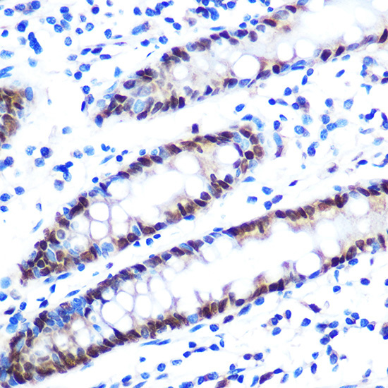 hnRNP A1 Rabbit Monoclonal Antibody - Image 3
