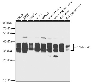 hnRNP A1 Rabbit Polyclonal Antibody