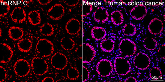 hnRNP C Rabbit Monoclonal Antibody - Image 4