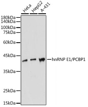 hnRNP E1/PCBP1 Rabbit Monoclonal Antibody
