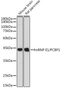 hnRNP E1/PCBP1 Rabbit Monoclonal Antibody - Image 2