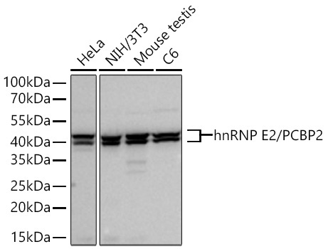 hnRNP E2/PCBP2 Rabbit Monoclonal Antibody