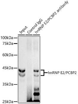hnRNP E2/PCBP2 Rabbit Monoclonal Antibody - Image 2