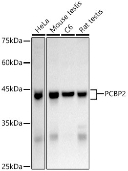 hnRNP E2/PCBP2 Rabbit Polyclonal Antibody