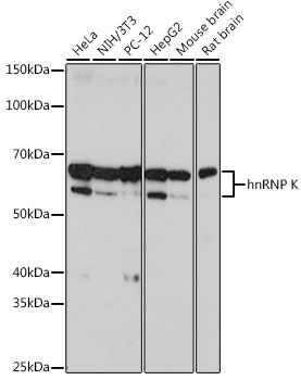 hnRNP K Rabbit Monoclonal Antibody