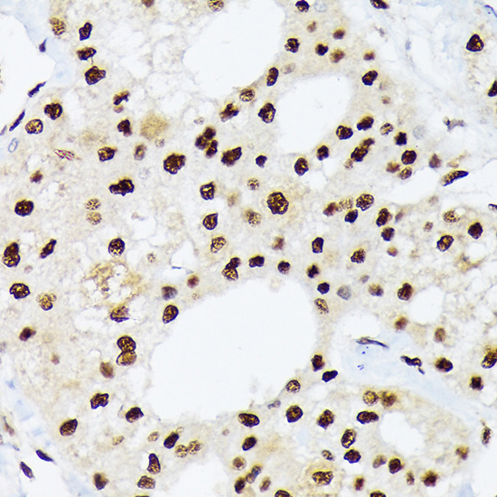 hnRNP Q/SYNCRIP Rabbit Monoclonal Antibody - Image 2