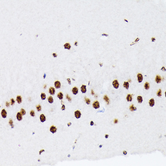 hnRNP Q/SYNCRIP Rabbit Monoclonal Antibody - Image 3