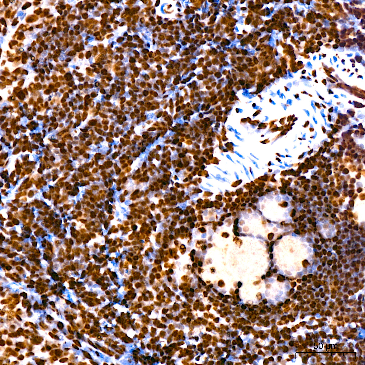 hnRNP U Rabbit Monoclonal Antibody - Image 10