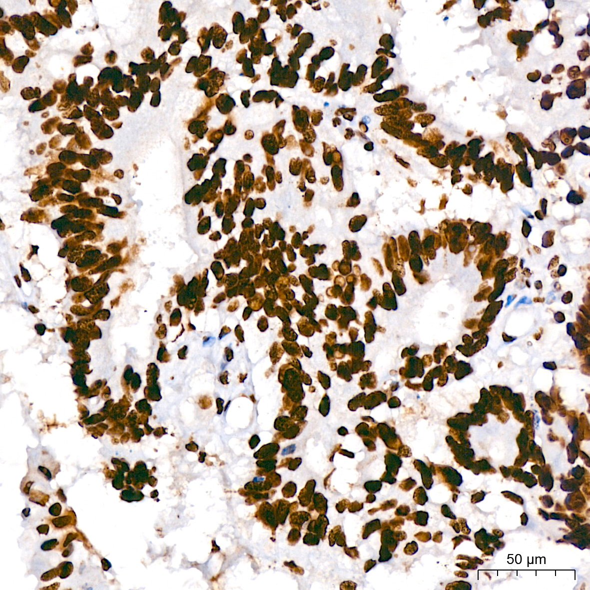 hnRNP U Rabbit Monoclonal Antibody - Image 2