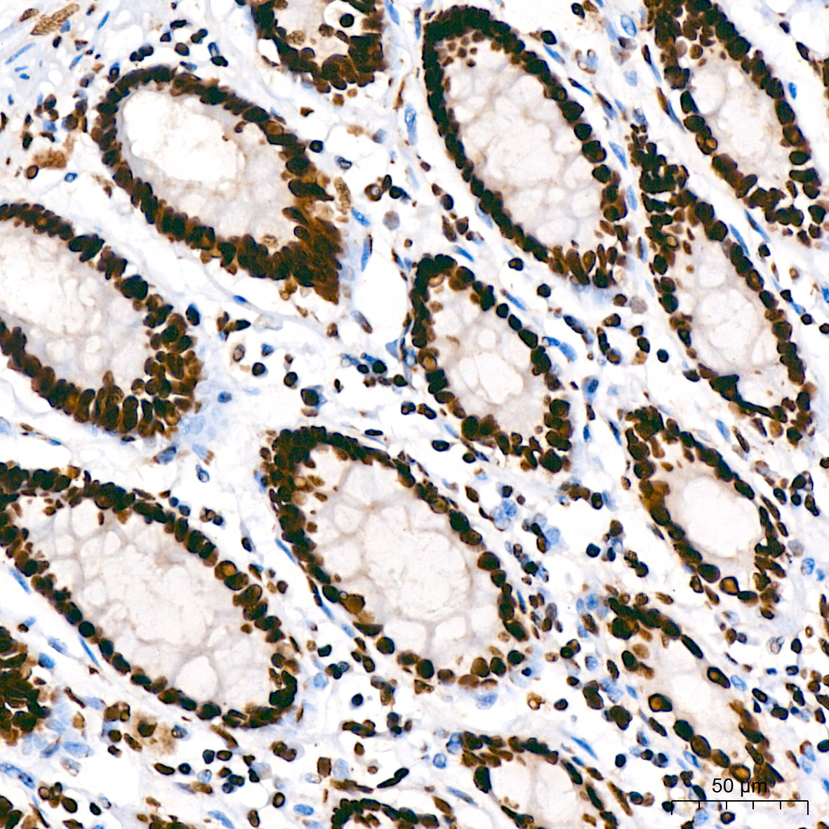hnRNP U Rabbit Monoclonal Antibody - Image 3