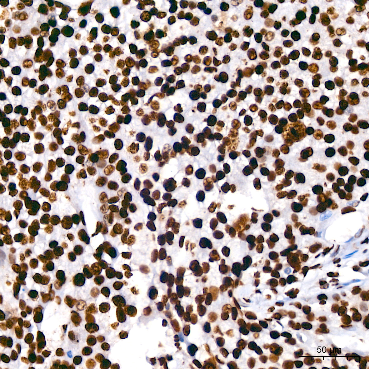 hnRNP U Rabbit Monoclonal Antibody - Image 4
