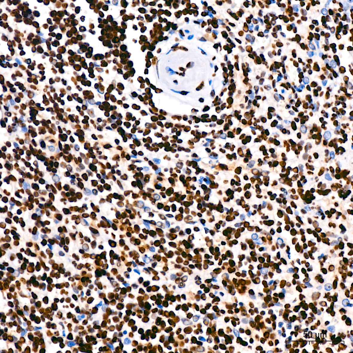 hnRNP U Rabbit Monoclonal Antibody - Image 5