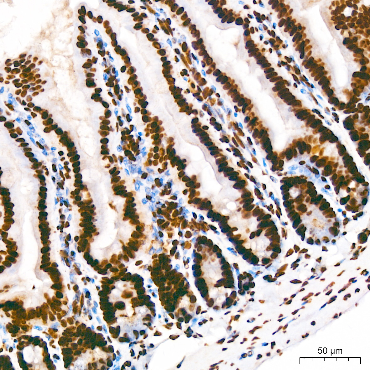 hnRNP U Rabbit Monoclonal Antibody - Image 6