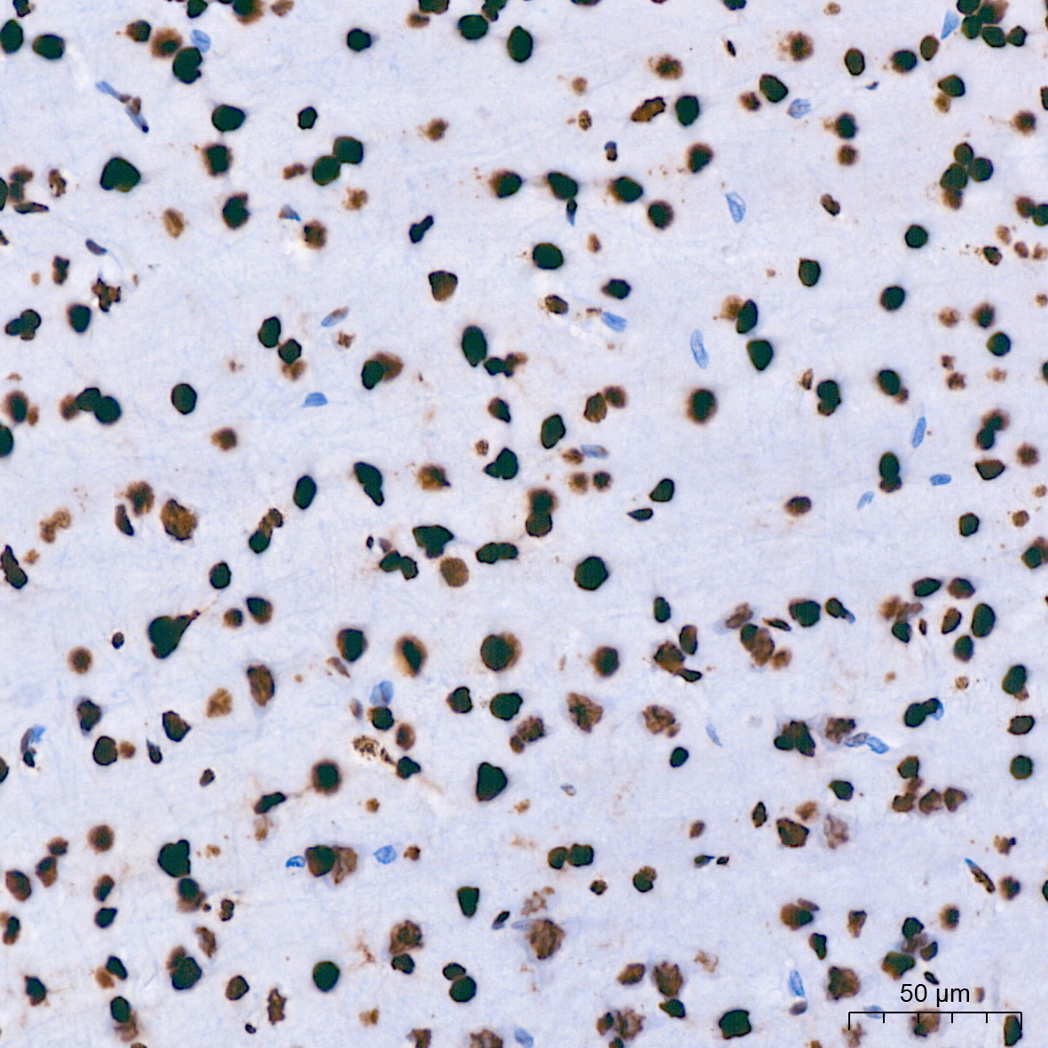 hnRNP U Rabbit Monoclonal Antibody - Image 8