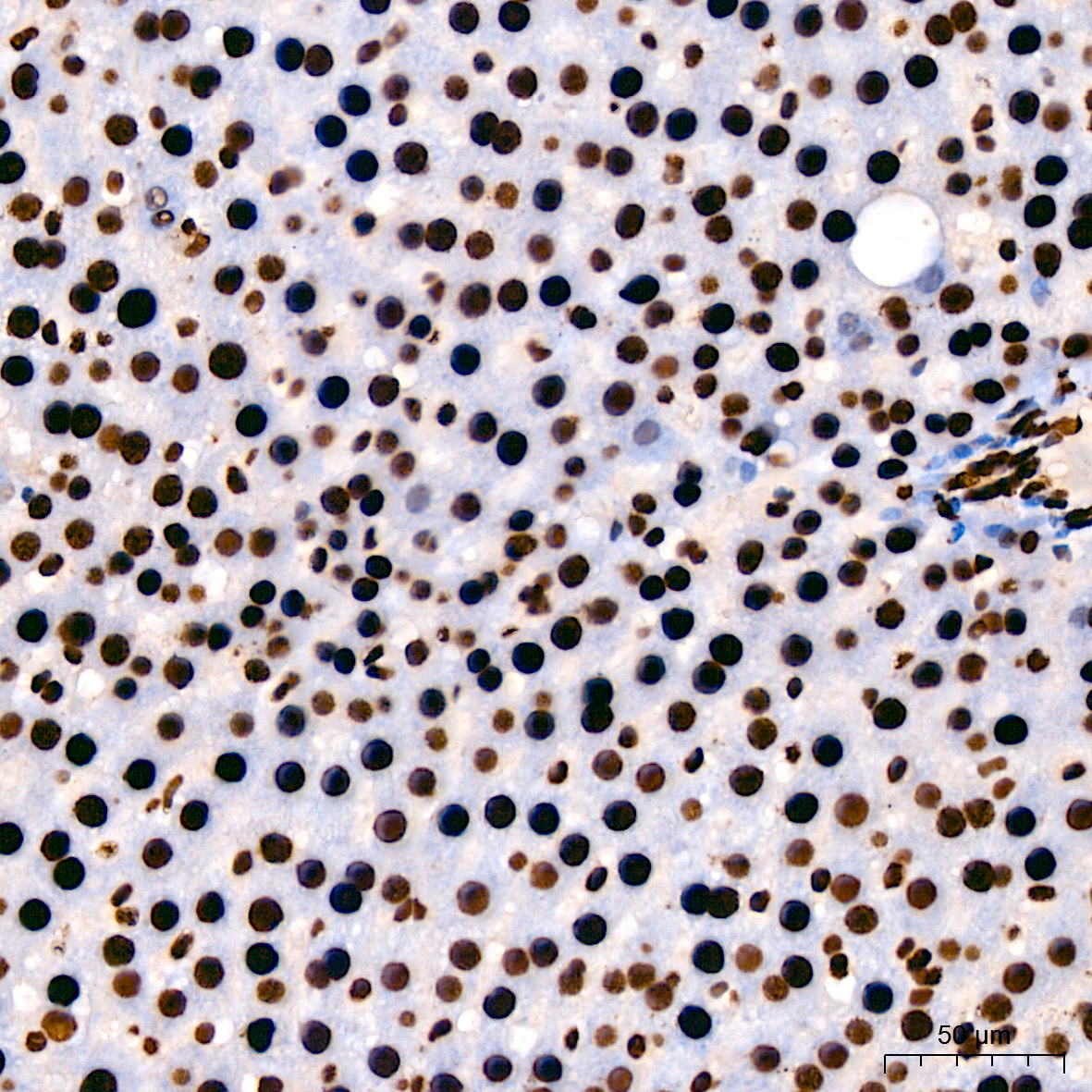 hnRNP U Rabbit Monoclonal Antibody - Image 9