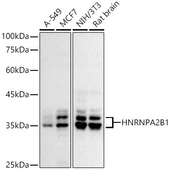 HNRNPA2B1 Rabbit Polyclonal Antibody