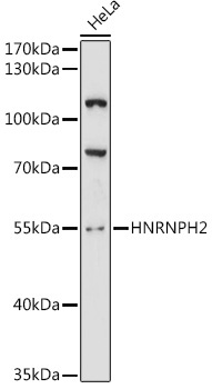 HNRNPH2 Rabbit Polyclonal Antibody