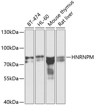 HNRNPM Rabbit Polyclonal Antibody