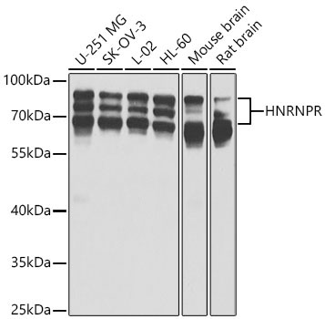 HNRNPR Rabbit Polyclonal Antibody